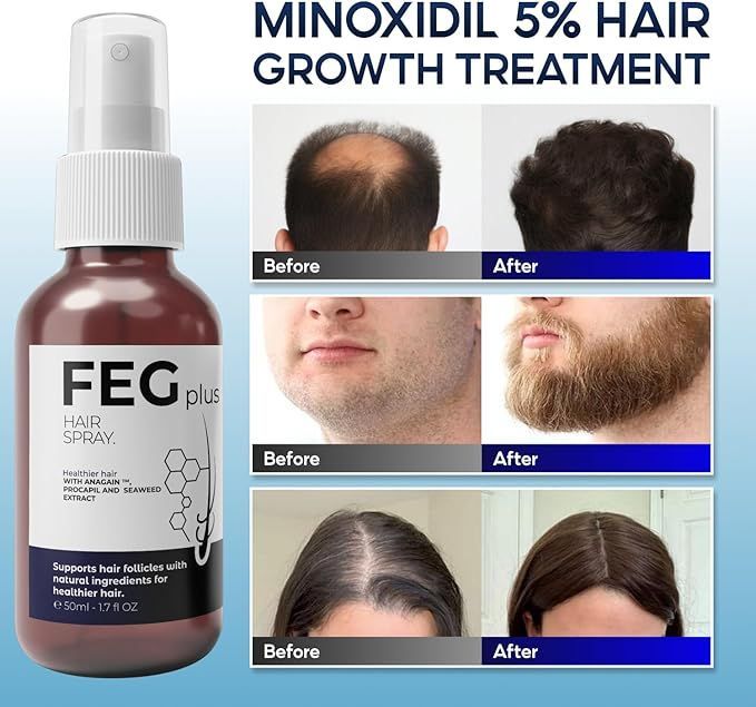 FEG PLUS HAIR SPRAY | 100% GUARANTEED RESULTS
